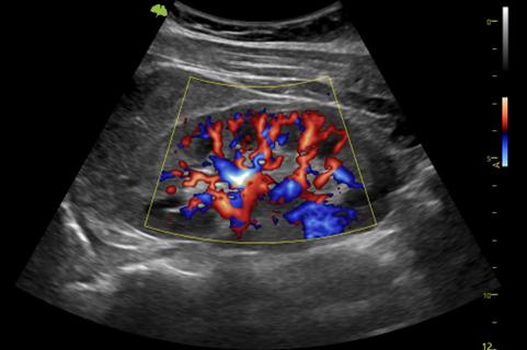 M&aacute;y si&ecirc;u &acirc;m 5D Vinno R500